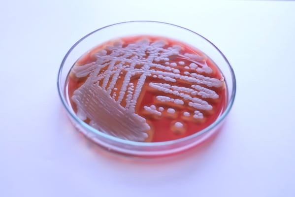 bacillus cereus